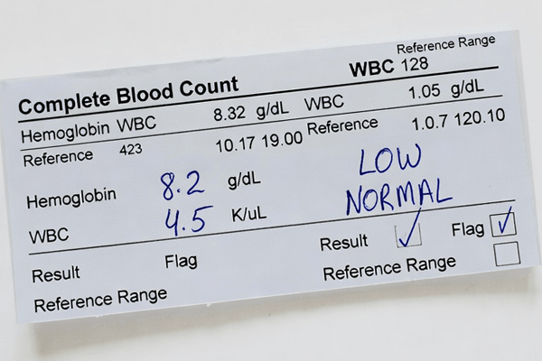 Гемоглобін. Рекомендовані продукти Vivasan, Швейцарія. Натуральні товари компанії Vivasan, Швейцарія в категорії Гемоглобін.