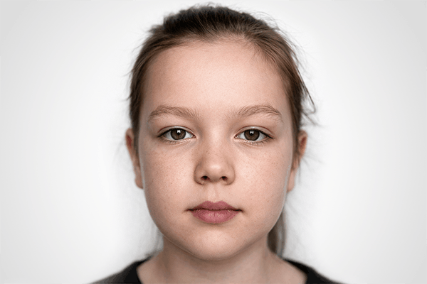 Проблемна шкіра. Рекомендовані продукти Vivasan, Швейцарія. Натуральні товари компанії Vivasan, Швейцарія в категорії Проблемна шкіра.