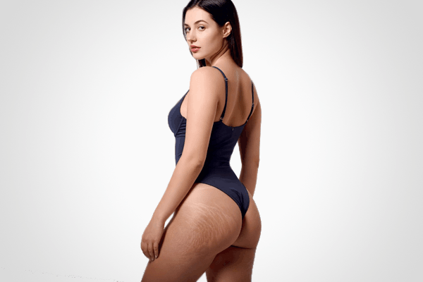 Целюліт. Рекомендовані продукти Vivasan, Швейцарія. Натуральні товари компанії Vivasan, Швейцарія в категорії Целюліт.